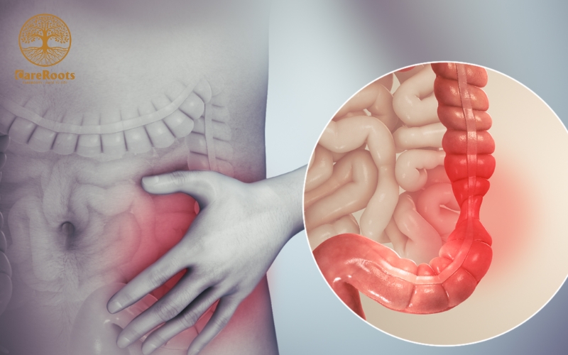 Uống Omega 3 Bị Tiêu Chảy? Hiểm Họa Hay Chỉ Là Hiểu Lầm Tai Hại?